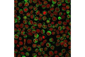 Immunofluorescence Analysis of PFA-fixed Raji cells labeling CD79a with CD79a Monoclonal Antibody (SPM550) followed by Goat anti-Mouse IgG-CF488 (Green).
