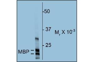 Western blot of rat cortex homogenate showing specific immunolabeling of the ~18 & 22k MBP protein. (MBP antibody)