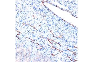 Immunohistochemistry of paraffin-embedded mouse kidney using Cadherin-13 (CDH13) Rabbit mAb (ABIN7265996) at dilution of 1:100 (40x lens). (Cadherin 13 antibody)