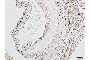 Formalin-fixed and paraffin embedded rat aorta labeled with Anti-LOX-1 Polyclonal Antibody, Unconjugated (ABIN676988) followed by conjugation to the secondary antibody and DAB staining (OLR1 antibody  (AA 201-273))