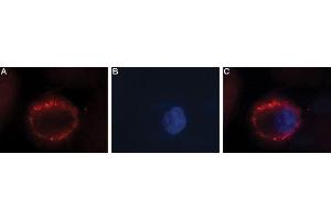 Expression of FSH receptor in human ovary cell line - Cell surface detection of FSH receptor in intact living human OVCAR3 cells. (FSHR antibody  (Extracellular))