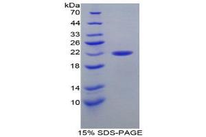 SDS-PAGE (SDS) image for Calreticulin (CALR) (AA 199-308) protein (His tag) (ABIN1877167) (Calreticulin Protein (CALR) (AA 199-308) (His tag))