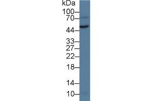 Detection of vWA1 in Rat Testis lysate using Polyclonal Antibody to Von Willebrand Factor A Domain Containing Protein 1 (vWA1) (VWA1 antibody  (AA 42-289))