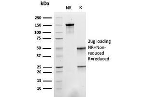 SDS-PAGE Analysis Purified ACTN2 Mouse Monoclonal Antibody (ACTN2/3293).