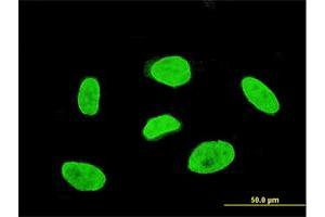Immunofluorescence of monoclonal antibody to TBX3 on HeLa cell. (TBX3 antibody  (AA 311-410))