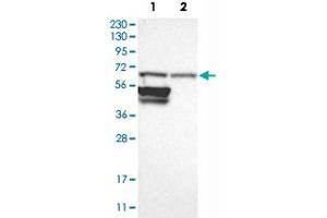 Western Blot analysis of Lane 1: RT-4 and Lane 2: U-251 MG sp cell lysates with RPN2 polyclonal antibody . (Ribophorin II antibody)