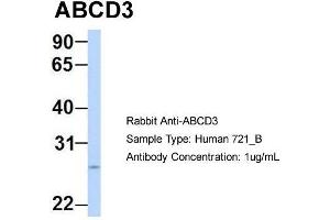Host: Rabbit Target Name: ABCD3 Sample Type: Human 721_B Antibody Dilution: 1. (CX3CL1 antibody  (N-Term))