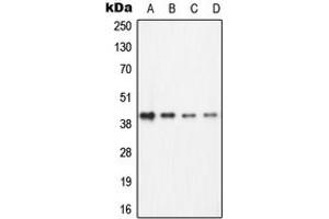Western blot analysis of ECA39 expression in Jurkat (A), Ramos (B), NIH3T3 (C), PC12 (D) whole cell lysates. (BCAT1 antibody  (C-Term))