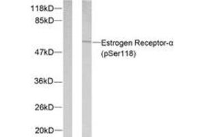 Western blot analysis of extracts from MCF7 cells treated with Estradiol, using Estrogen Receptor-alpha (Phospho-Ser118) Antibody. (Estrogen Receptor alpha antibody  (pSer118))