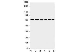Western blot testing of Apoptosis-Inducing Factor antibody and Lane 1:  rat heart (AIF antibody  (C-Term))