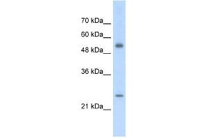 AK3L1 antibody used at 2. (AK4 antibody  (Middle Region))