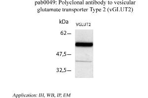 Image no. 1 for anti-Solute Carrier Family 17 (Vesicular Glutamate Transporter), Member 6 (SLC17A6) (C-Term) antibody (ABIN346996) (Solute Carrier Family 17 (Vesicular Glutamate Transporter), Member 6 (SLC17A6) (C-Term) antibody)