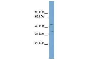 WB Suggested Anti-SLC39A8 Antibody Titration:  0. (SLC39A8 antibody  (N-Term))