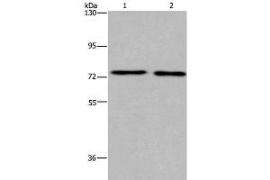 Western Blot analysis of Human fetal brain and Mouse brain tissue using KCNQ4 Polyclonal Antibody at dilution of 1:200 (KCNQ4 antibody)