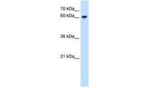 Image no. 2 for anti-Zinc Finger Protein 169 (ZNF169) (AA 252-301) antibody (ABIN6739214) (ZNF169 antibody  (AA 252-301))