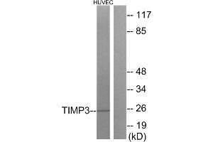 Western blot analysis of extracts from HUVEC cells, using TIMP3 antibody. (TIMP3 antibody  (Internal Region))