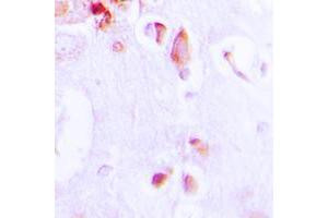 Immunohistochemical analysis of ARRDC3 staining in human brain formalin fixed paraffin embedded tissue section. (ARRDC3 antibody  (C-Term))