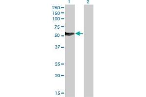 Western Blotting (WB) image for anti-Nuclear Factor I/B (NFIB) (AA 1-420) antibody (ABIN518322)