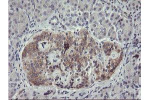 Immunohistochemical staining of paraffin-embedded Human pancreas tissue using anti-EIF5A2 mouse monoclonal antibody.