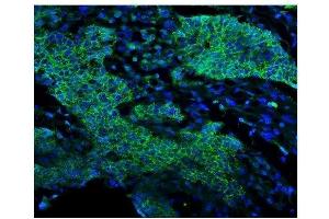 IF analysis of EGFR using anti-EGFR antibody (ABIN7601478). (EGFR antibody  (AA 36-497))