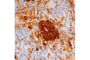 Staining of paraffin embedded human pancreas with mouse anti rat Insulin. (Insulin antibody)