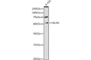 Western blot analysis of extracts of A-431 cells, using FBLN5 antibody (ABIN6127927, ABIN6140497, ABIN6140498 and ABIN6225300) at 1:1000 dilution. (Fibulin 5 antibody  (AA 199-448))