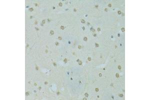 Immunohistochemistry of paraffin-embedded mouse brain using SAFB antibody.