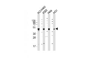 All lanes : Anti-CYK18 Antibody (C-term) at 1:2000 dilution Lane 1: NCI- whole cell lysate Lane 2: K562 whole cell lysate Lane 3: Hela whole cell lysate Lane 4: A431 whole cell lysate Lysates/proteins at 20 μg per lane. (Cytokeratin 18 antibody  (C-Term))