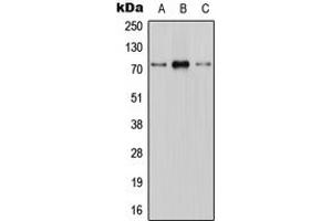 Western blot analysis of CNT1 expression in HEK293T (A), mouse brain (B), H9C2 (C) whole cell lysates. (SLC28A1 antibody  (Center))