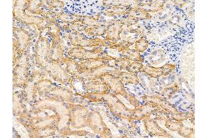 ABIN7094606 and ABIN7098656 at 1/100 staining Rat kidney tissue by IHC-P.