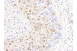 Immunohistochemistry (IHC) image for anti-Proteasome (Prosome, Macropain) Subunit, beta Type, 7 (PSMB7) (AA 150-200) antibody (ABIN7453543)