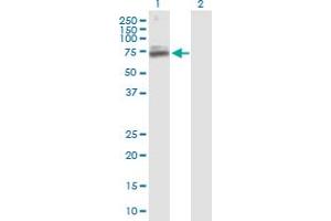 Western Blotting (WB) image for anti-Tigger Transposable Element Derived 1 (TIGD1) (AA 1-591) antibody (ABIN531269)