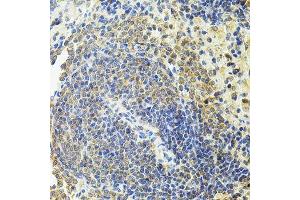 Immunohistochemistry of paraffin-embedded rat spleen using RALBP1 antibody. (RALBP1 antibody  (AA 396-655))