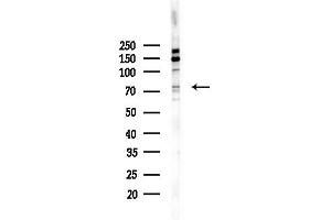 anti-Carnitine O-Octanoyltransferase (CROT) (Internal Region) antibody
