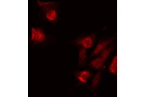 ABIN6268928 staining 293 by IF/ICC. (Caspase 6 antibody  (Cleaved-Asp179))