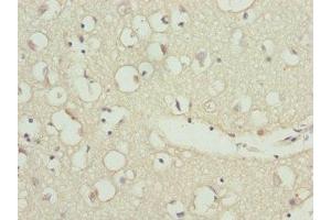 Immunohistochemistry of paraffin-embedded human brain tissue using ABIN7176197 at dilution of 1:100