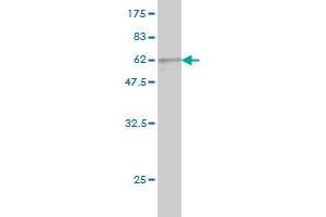 Western Blot detection against Immunogen (57. (PIH1D1 antibody  (AA 1-290))