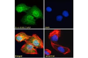 ABIN184965 Immunofluorescence analysis of paraformaldehyde fixed U2OS cells, permeabilized with 0. (TRIM21 antibody  (C-Term))
