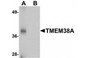 Western blot analysis of TMEM38A in rat skeletal muscle tissue lysate with TMEM38A antibody at 1 μg/mL in (A) the absence and (B) the presence of blocking peptide.