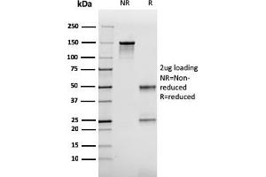 SDS-PAGE Analysis Purified FABP2 Mouse Monoclonal Antibody (CPTC-FABP2-3). (FABP2 antibody)