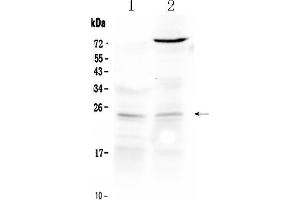 Western blot analysis of TIMP3 using anti- TIMP3 antibody . (TIMP3 antibody  (Middle Region))