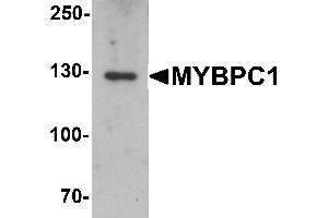 Western blot analysis of MYBPC1 in rat skeletal muscle tissue lysate with MYBPC1 antibody at 1 µg/mL. (MYBPC1 antibody  (N-Term))