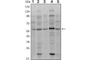 Western blot analysis using SMAD4 mouse mAb against A431 (1), SK-N-SH (2), K562 (3), HepG2 (4) and HUVE12 (5) cell lysate. (SMAD4 antibody)