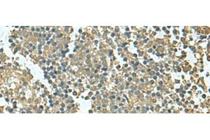 Immunohistochemistry of paraffin-embedded Human tonsil tissue using KRT36 Polyclonal Antibody at dilution of 1:50(x200) (Keratin 36 antibody)