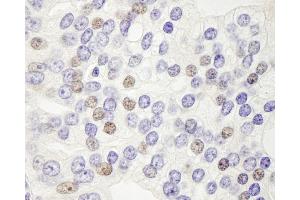 Immunohistochemistry (IHC) image for anti-DEK Oncogene (DEK) (AA 225-275) antibody (ABIN7448525)