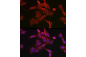 Immunofluorescence analysis of PC-12 cells using Cathepsin B Rabbit pAb (ABIN3021175, ABIN3021176, ABIN3021177 and ABIN6214050) at dilution of 1:100 (40x lens). (Cathepsin B antibody  (AA 1-339))