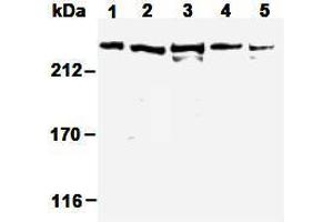 Western Blotting (WB) image for anti-Nuclear Mitotic Apparatus Protein 1 (NUMA1) antibody (ABIN1449239) (NUMA1 antibody)