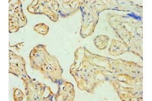 Immunohistochemistry of paraffin-embedded human placenta tissue using ABIN7170774 at dilution of 1:100 (SOAT1 antibody  (AA 1-130))