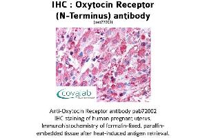 Image no. 1 for anti-Oxytocin Receptor (OXTR) (Extracellular Domain), (N-Term) antibody (ABIN1737740) (Oxytocin Receptor antibody  (Extracellular Domain, N-Term))
