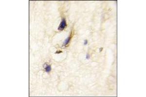 Image no. 1 for anti-Dishevelled Associated Activator of Morphogenesis 1 (DAAM1) (C-Term), (N-Term) antibody (ABIN357856) (DAAM1 antibody  (C-Term, N-Term))